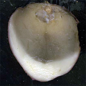 Dry rot lesion colonized by soft rot bacteria. Dry rot lesion colonized by soft rot bacteria.