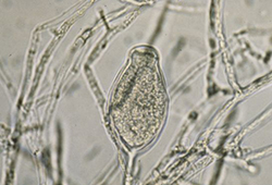 Phytophthora asexual spore